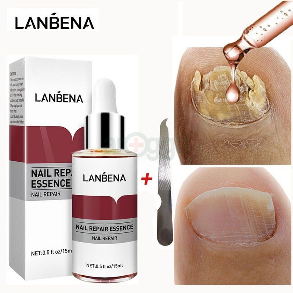 LANBENA Nail Repair Essence